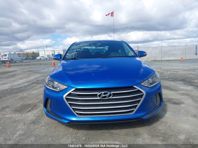 KMHD84LF4HU130462 Hyundai Elantra