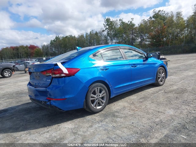 KMHD84LF4HU130462 Hyundai Elantra