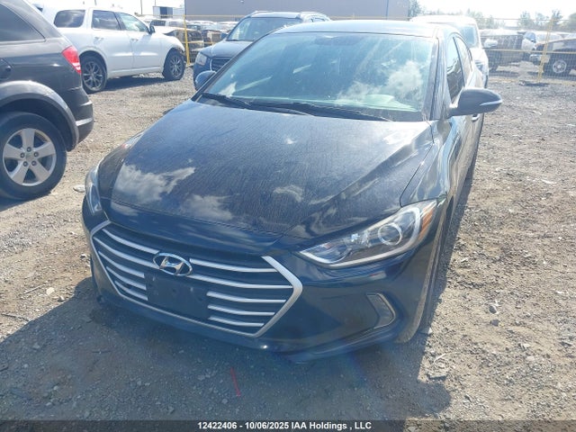 KMHD84LF9JU668855 Hyundai mpi nu