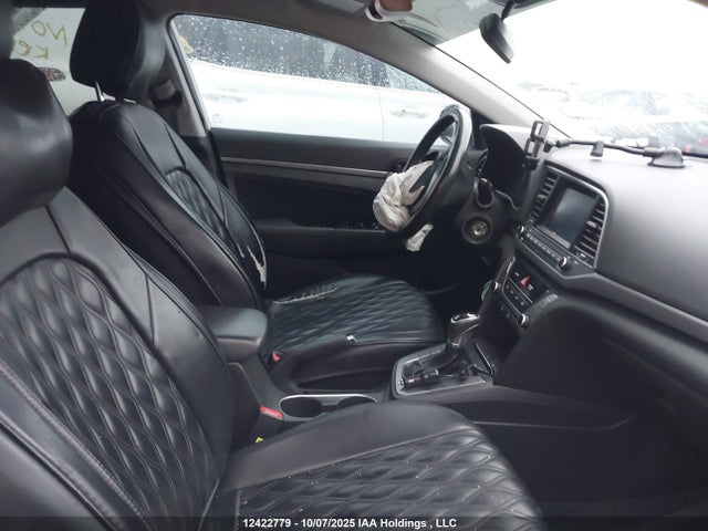 KMHD84LFXHU344744 Hyundai 2017