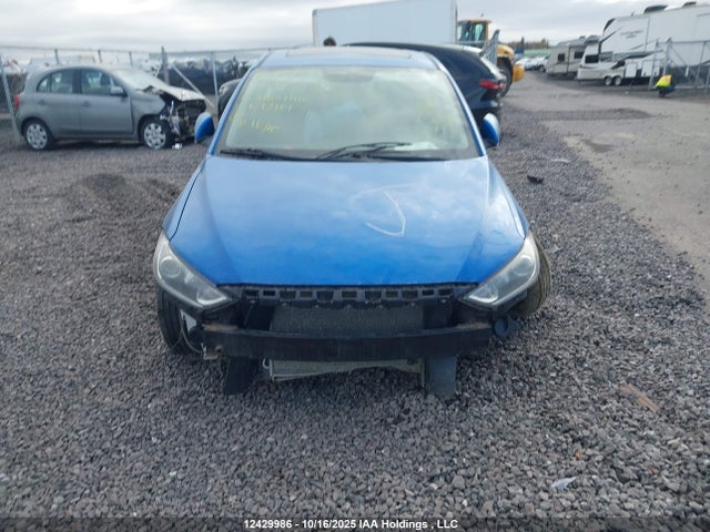 KMHD84LF8JU692161 Hyundai mpi nu