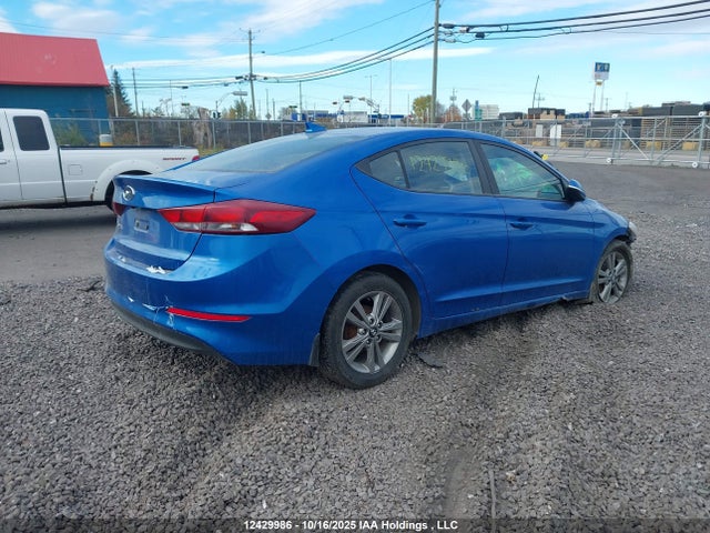 KMHD84LF8JU692161 Hyundai mpi nu