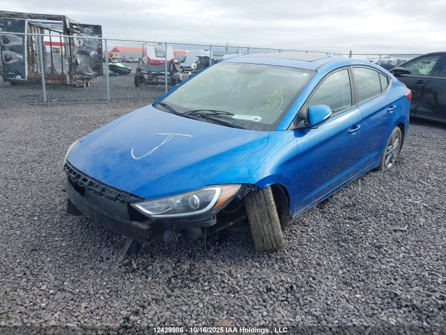 KMHD84LF8JU692161 Hyundai mpi nu