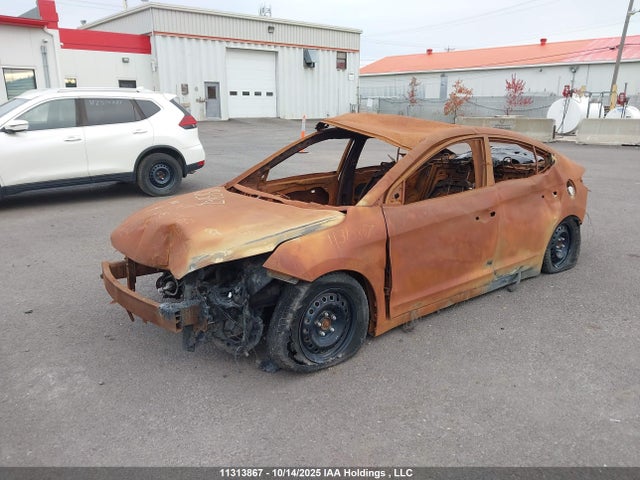 Hyundai mpi nu 2020 KMHD74LF5LU908036 Image 2