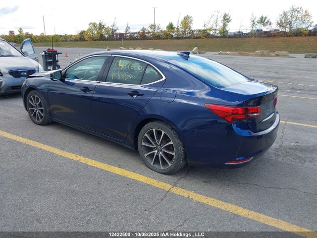 Acura j35y6 2015 19UUB3F50FA801726 Image 3