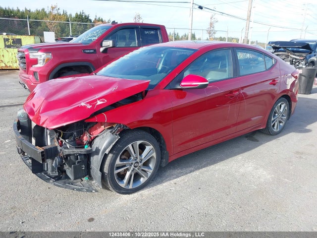 KMHD84LF1JU649541 Hyundai Elantra Gls
