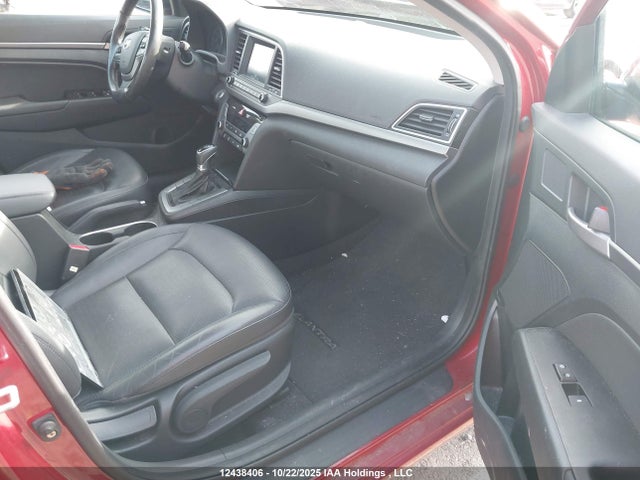 KMHD84LF1JU649541 Hyundai Elantra Gls