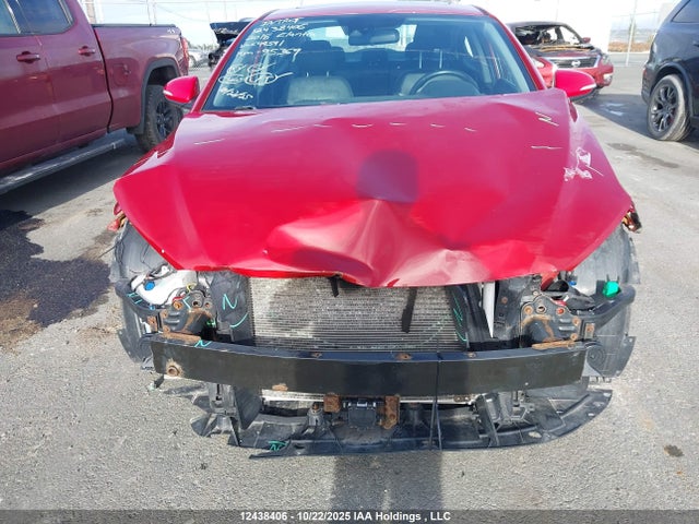 KMHD84LF1JU649541 Hyundai Elantra Gls