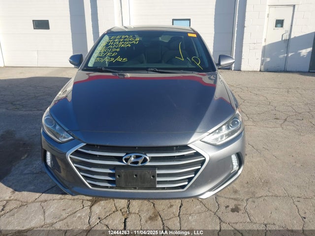 KMHD84LF7JU680194 Hyundai Elantra Sel/value/limited