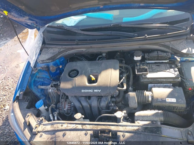 KMHD84LF1JU663830 Hyundai Elantra Gls