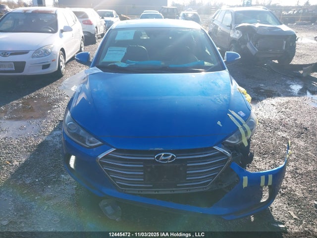 KMHD84LF1JU663830 Hyundai Elantra Gls