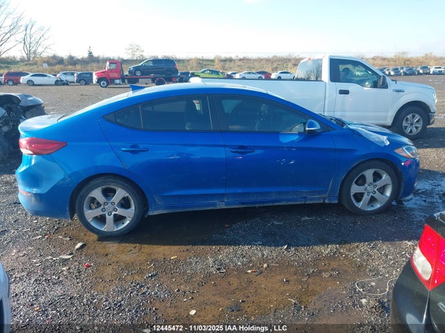 KMHD84LF1JU663830 Hyundai Elantra Gls
