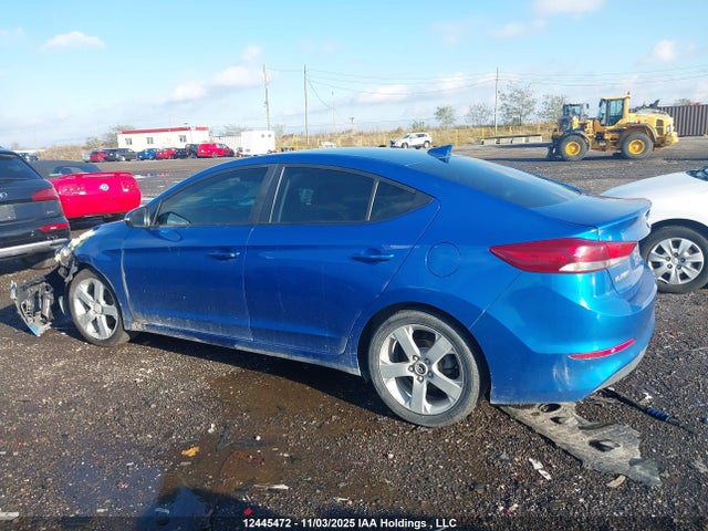 KMHD84LF1JU663830 Hyundai Elantra Gls