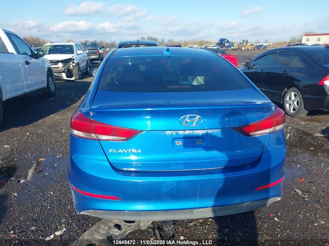 KMHD84LF1JU663830 Hyundai Elantra Gls