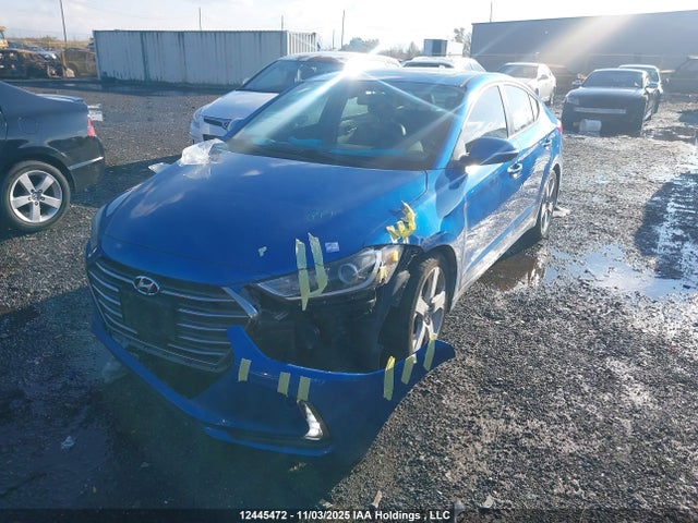 KMHD84LF1JU663830 Hyundai Elantra Gls