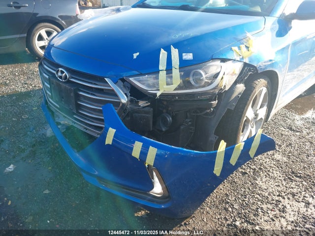 KMHD84LF1JU663830 Hyundai Elantra Gls