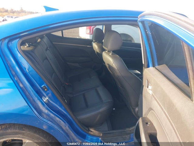 KMHD84LF1JU663830 Hyundai Elantra Gls