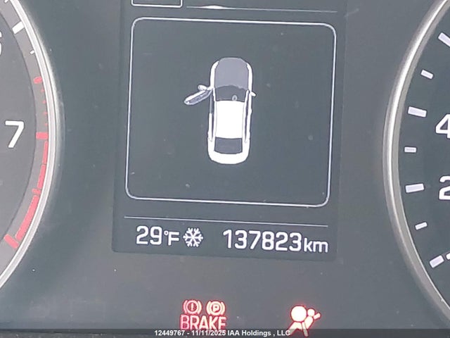 KMHD84LF3HU218080 Hyundai Elantra