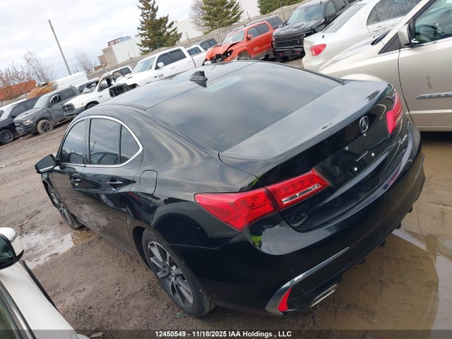 Acura j35y6 2019 19UUB3F31KA802411 Image 3