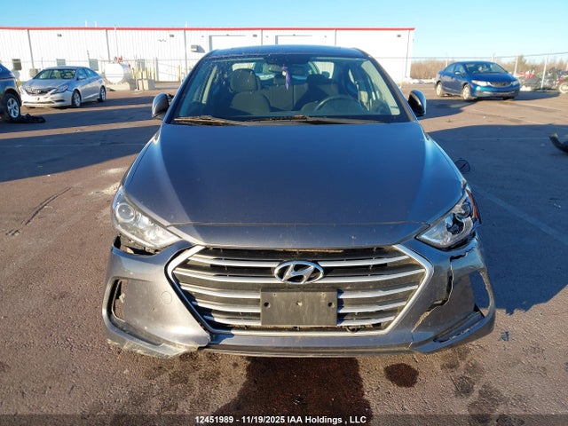KMHD84LF3JU691242 Hyundai Elantra Gl Se
