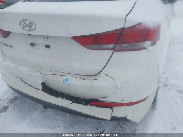 KMHD84LF3HU125267 Hyundai Elantra Gls