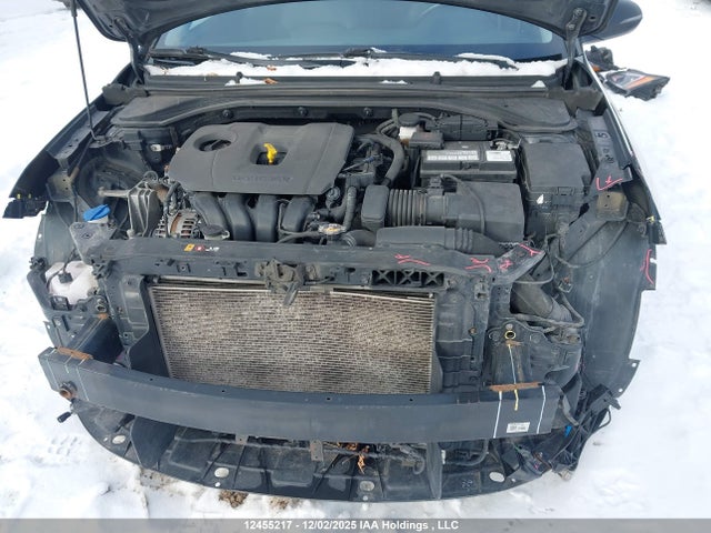 KMHD84LF7LU085493 Hyundai Elantra Luxury