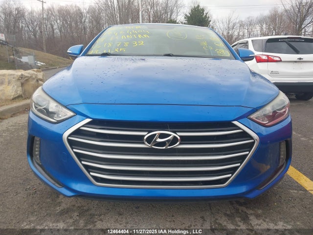 KMHD84LFXHU187832 Hyundai Elantra