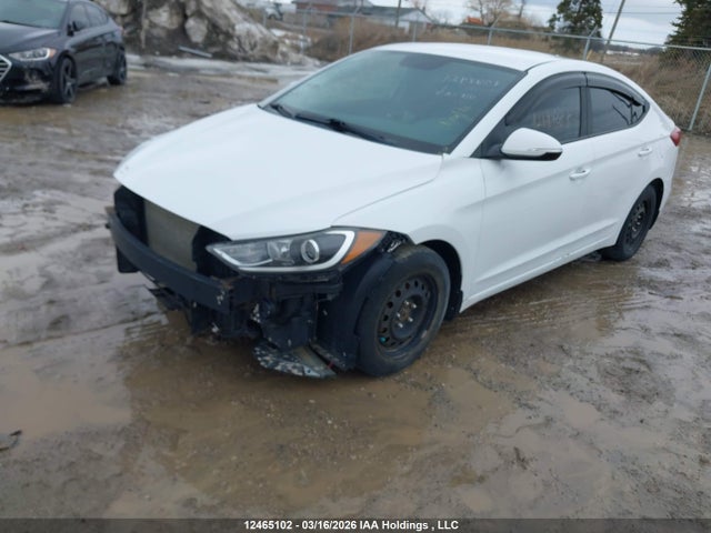 KMHD84LF1HU113716 Hyundai ELANTRA GL