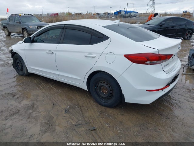 KMHD84LF1HU113716 Hyundai ELANTRA GL