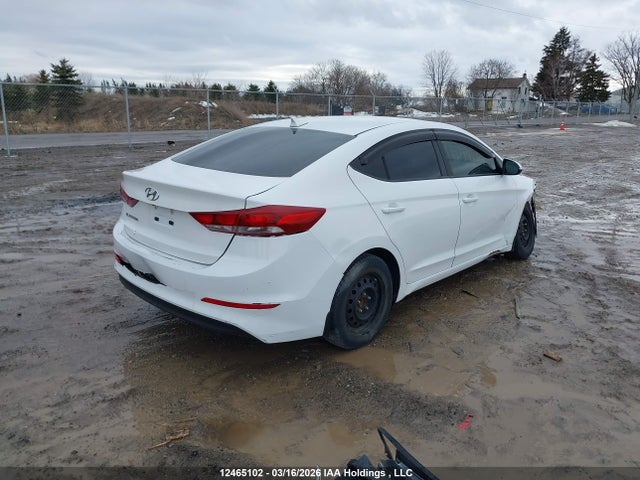 KMHD84LF1HU113716 Hyundai ELANTRA GL
