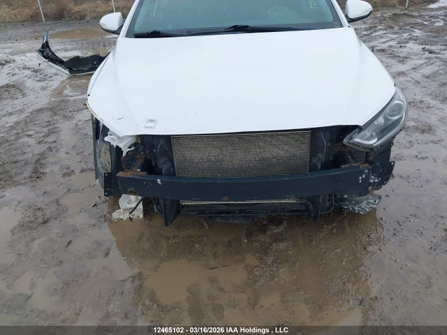 KMHD84LF1HU113716 Hyundai ELANTRA GL