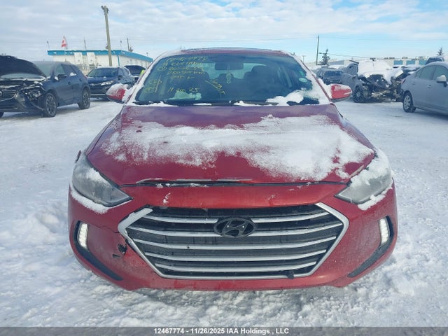 KMHD84LF0HU267639 Hyundai Elantra Se/value/limited