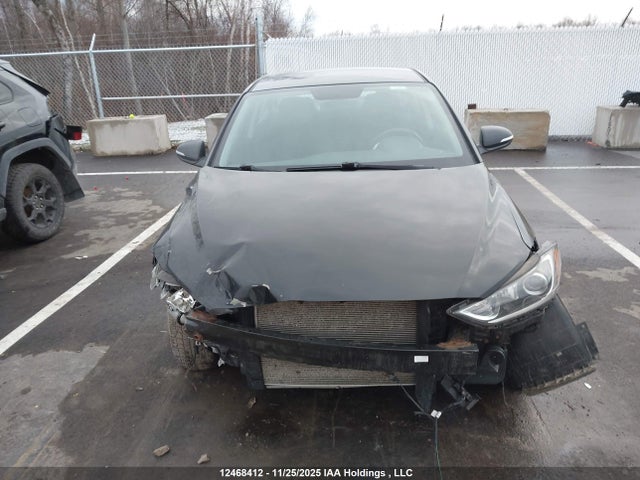 KMHD84LF6JU581558 Hyundai ELANTRA GL