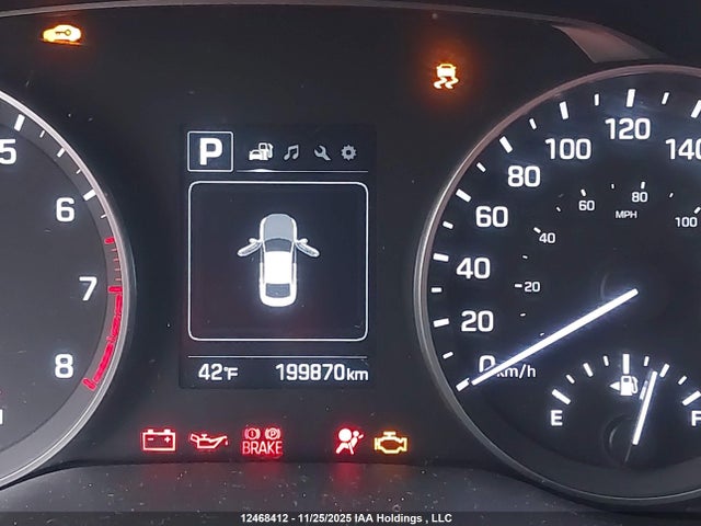 KMHD84LF6JU581558 Hyundai ELANTRA GL