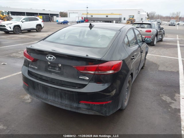 KMHD84LF6JU581558 Hyundai ELANTRA GL