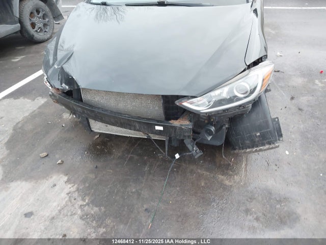KMHD84LF6JU581558 Hyundai ELANTRA GL