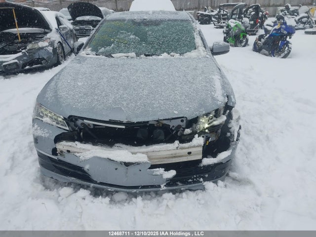 19UUB1F56FA800620 Acura TLX TECH