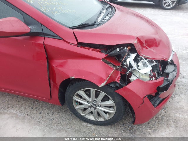 KMHDH4AE6GU530337 Hyundai Elantra Se/sport/limited