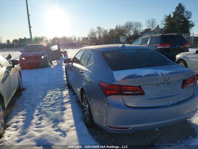 Acura TLX TECH 2015 19UUB1F51FA801478 Image 3