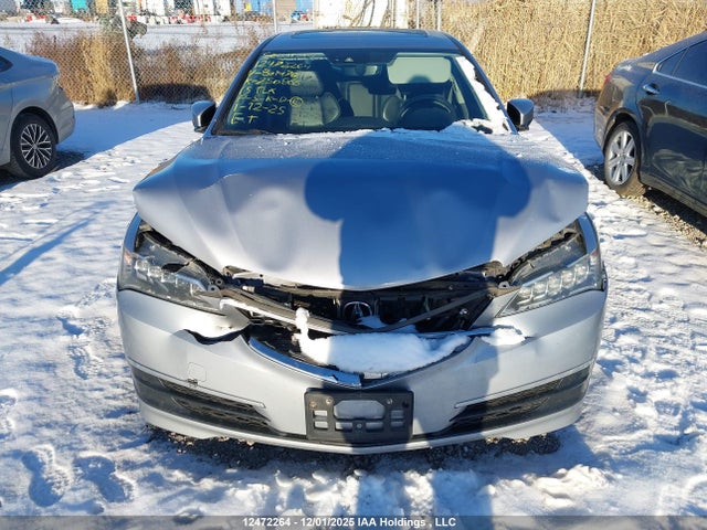 Acura TLX TECH 2015 19UUB1F51FA801478 Image 6