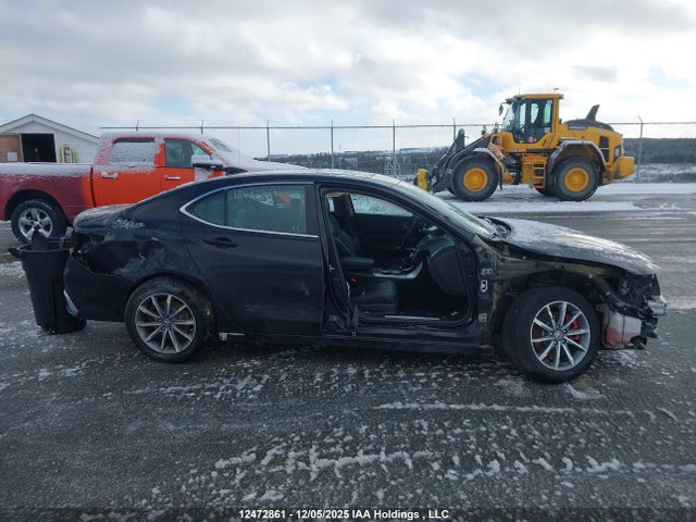 19UUB1F3XJA800627 Acura TLX