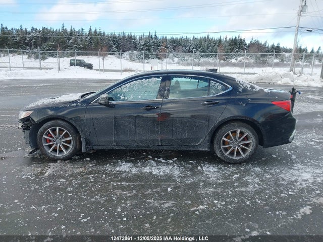 19UUB1F3XJA800627 Acura TLX
