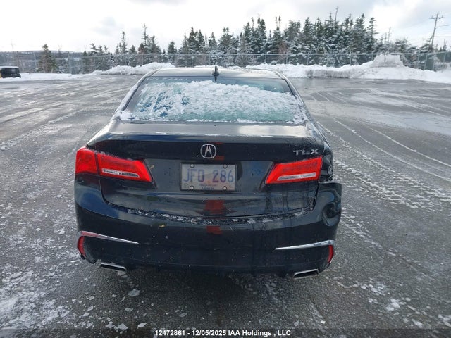19UUB1F3XJA800627 Acura TLX