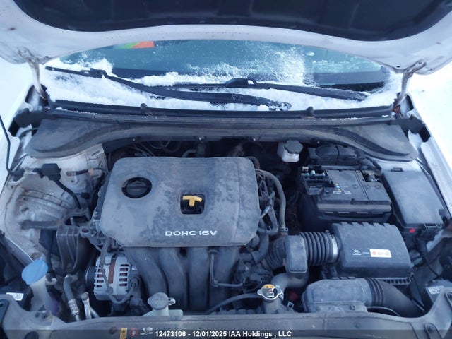 KMHD84LF9JU649657 Hyundai ELANTRA GL