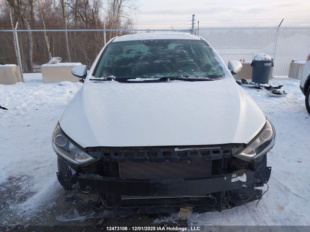 KMHD84LF9JU649657 Hyundai ELANTRA GL