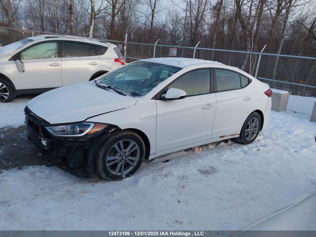 KMHD84LF9JU649657 Hyundai ELANTRA GL