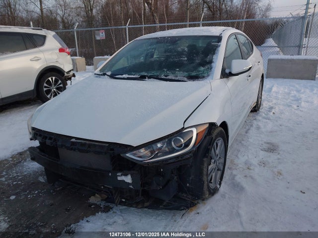 KMHD84LF9JU649657 Hyundai ELANTRA GL