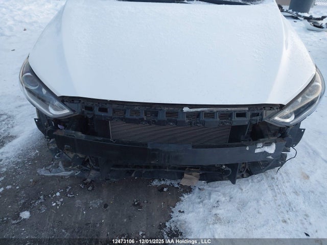 KMHD84LF9JU649657 Hyundai ELANTRA GL