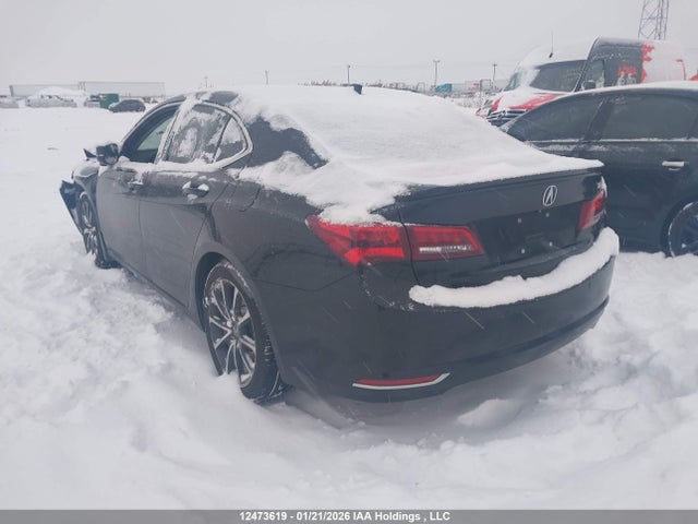 Acura TLX 2015 19UUB3F75FA803568 Image 3