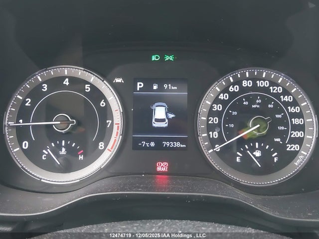 Hyundai Venue Ultimate With Black Interior 2022 KMHRC8A35NU175572 Image 7